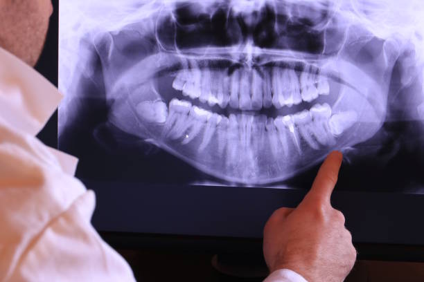 Best Weekend Emergency Dentist in Longbranch, WA