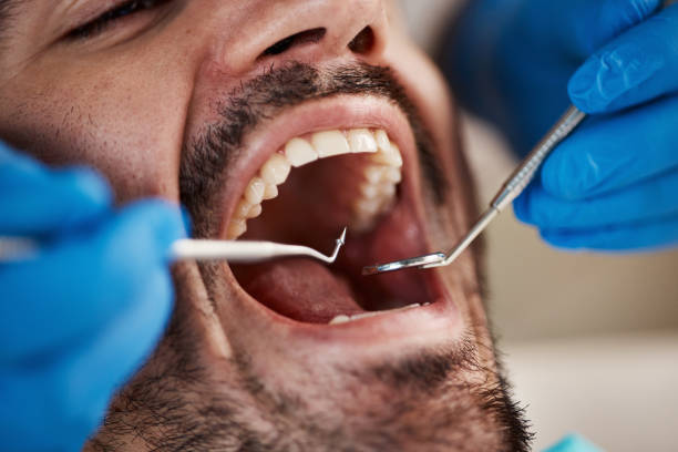 Best Emergency Dental Care for Trauma or Injury in Longbranch, WA